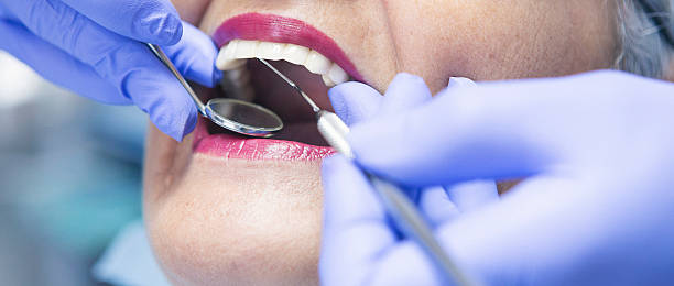 Best Emergency Wisdom Teeth Removal in Dove Valley, CO